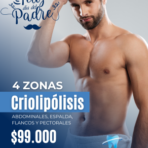 4 zonas de Criolipólisis hombre