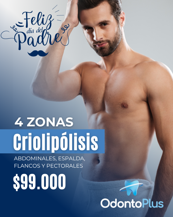 4 zonas de Criolipólisis hombre