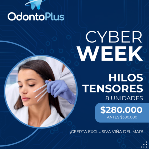 Hilos Tensores