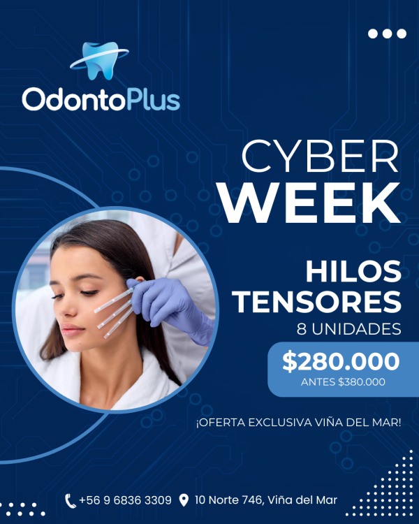 Hilos Tensores