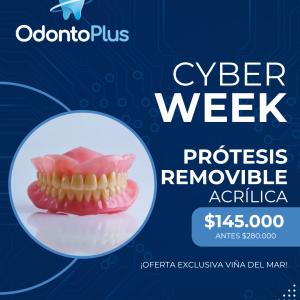 Prótesis Removible Acrílica