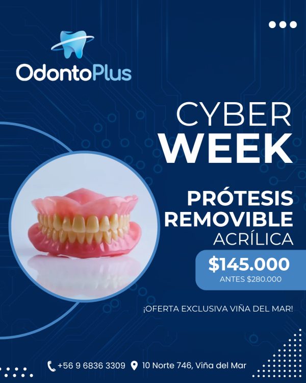 Prótesis Removible Acrílica