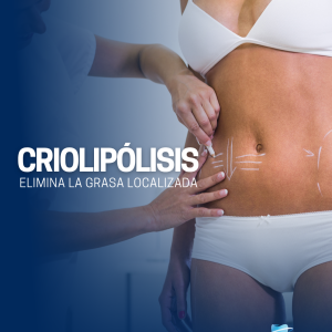 Criolipólisis 4 zonas